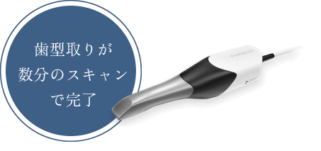 歯型取りが数分のスキャンで完了